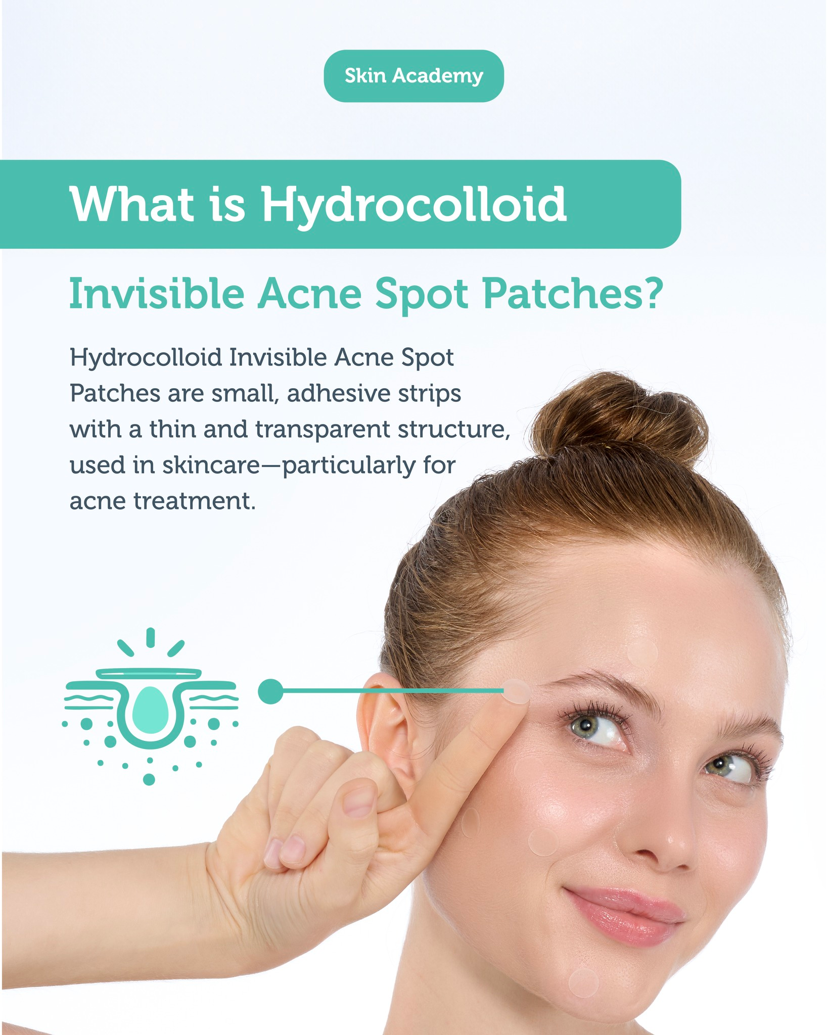 Hydrocolloid Invisible Acne Spot Patches